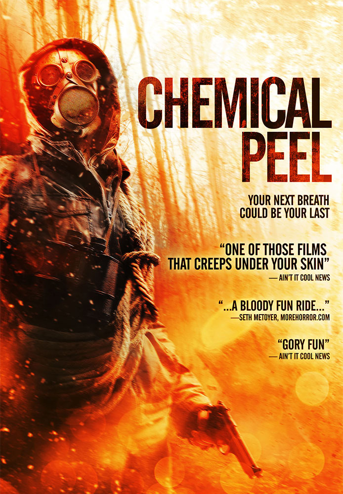 Chemical Peel