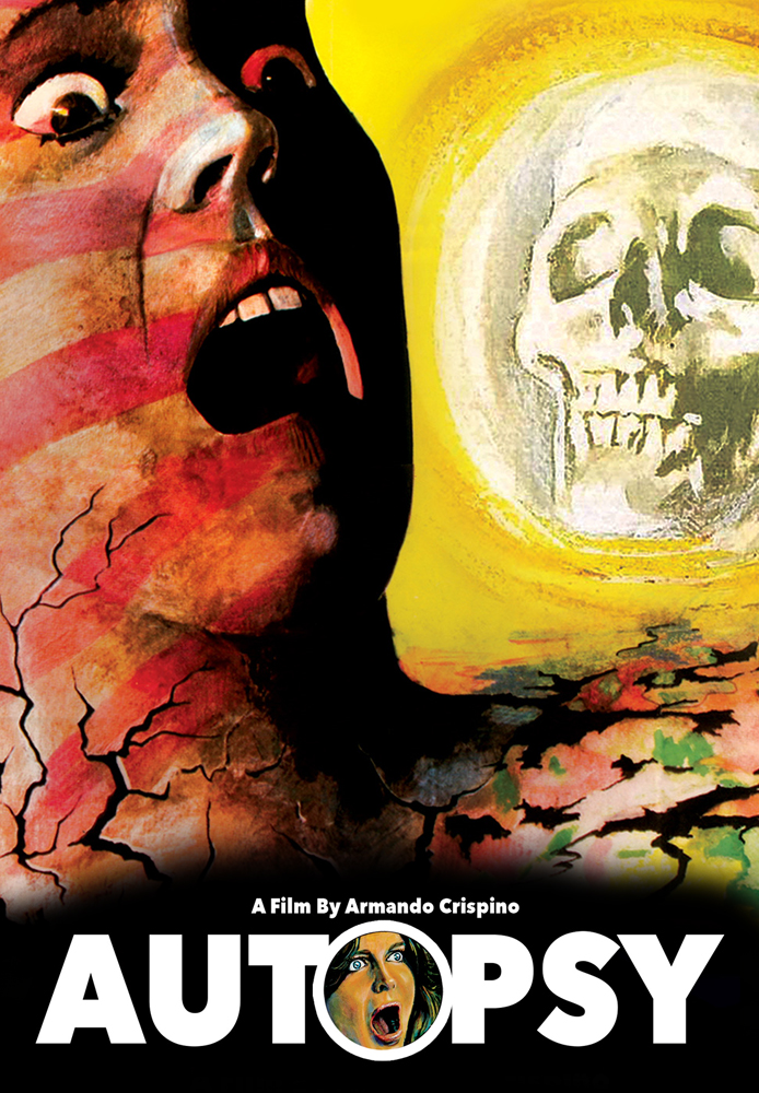 Autopsy