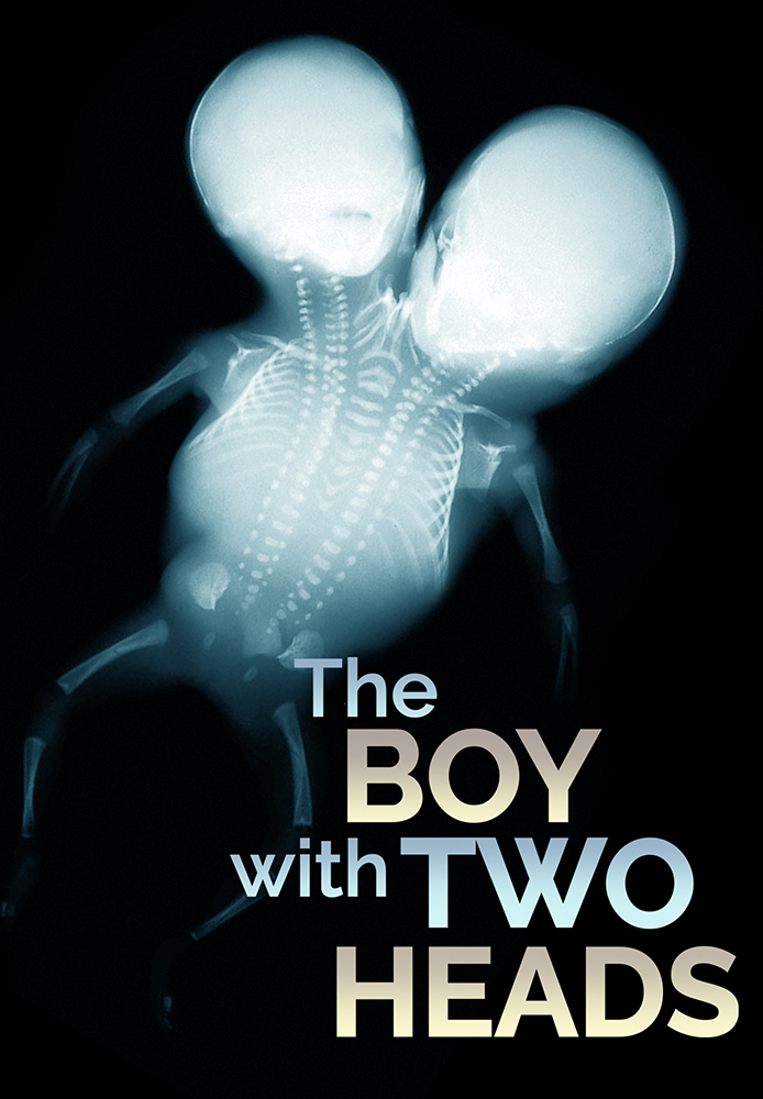 Boy with Two Heads