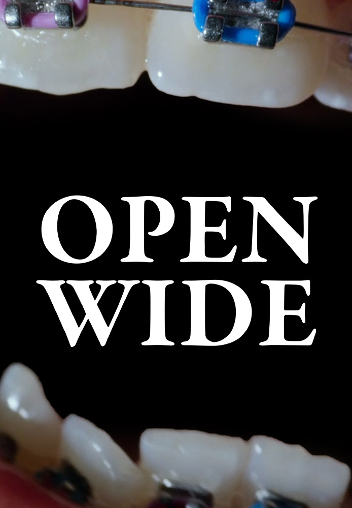 Open Wide