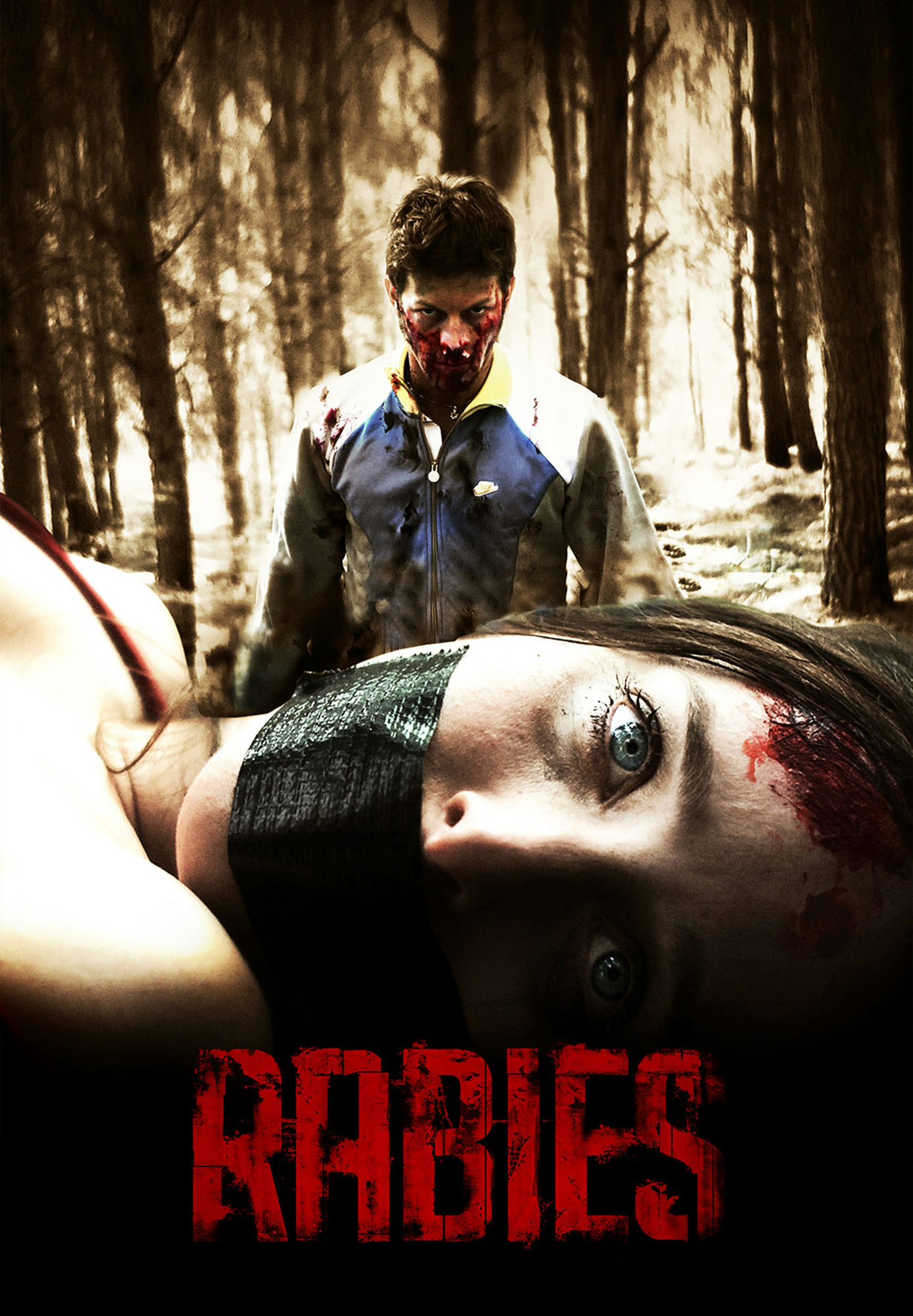 Rabies