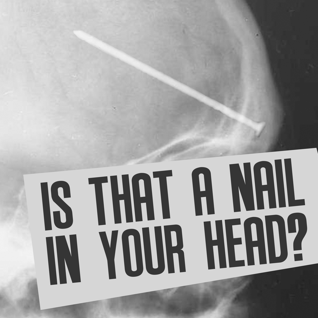 Is That A Nail In Your Head?